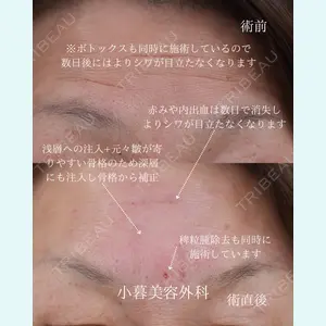 小暮整形外科・美容外科の症例
