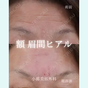 小暮整形外科・美容外科の症例