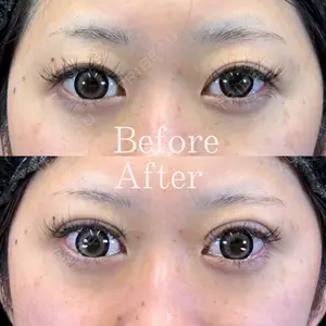 Leap beauty clinic 土門 駿也医師の症例