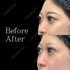 Leap beauty clinic 土門 駿也医師の症例