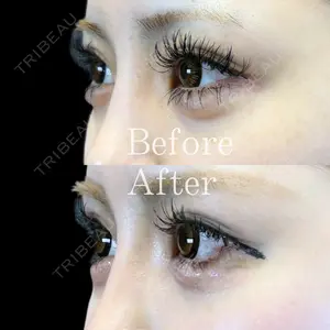 Leap beauty clinic 土門 駿也医師の症例