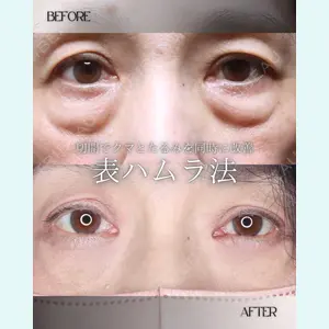 小倉美容外科/美容皮膚科 ビラビューティークリニック 大村 亞蘭医師の症例