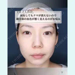 小倉美容外科/美容皮膚科 ビラビューティークリニック 大村 亞蘭医師の症例