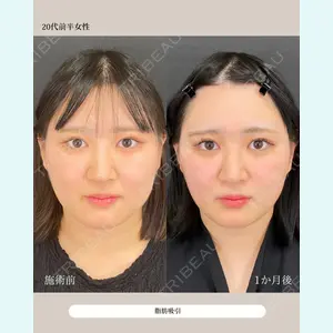 自由が丘ウェルエイジングビューティークリニック 福田 知佐子医師の症例