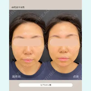 自由が丘ウェルエイジングビューティークリニック 福田 知佐子医師の症例