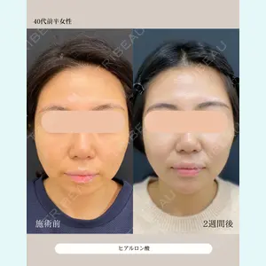 自由が丘ウェルエイジングビューティークリニック 福田 知佐子医師の症例