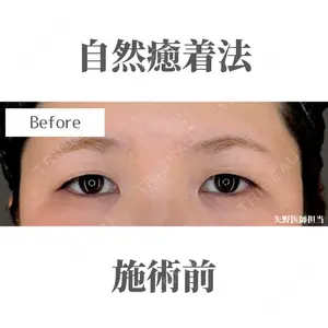 症例