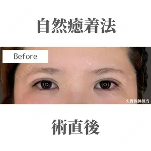 症例