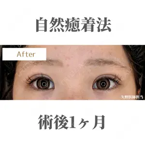 症例