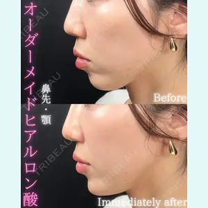 THE FIRST CLINIC 町田院 木暮 啓一郎医師の症例