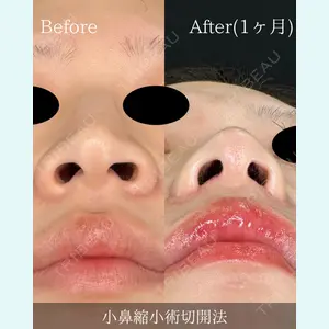 症例