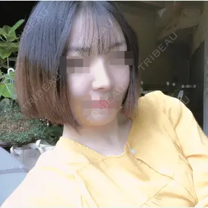加美（GAMI）整形外科 パク・ゴヌク医師の症例