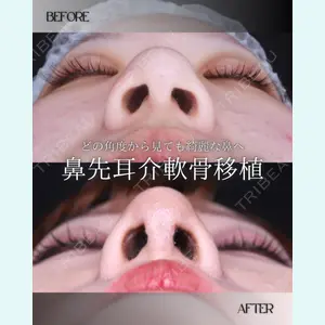 小倉美容外科/美容皮膚科 ビラビューティークリニック 大村 亞蘭医師の症例