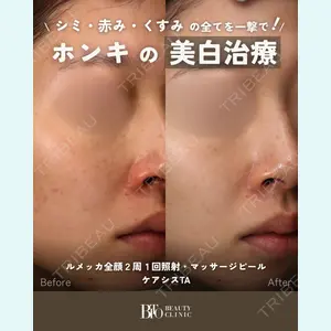 BITO BEAUTY CLINIC 伊藤 富良野医師の症例