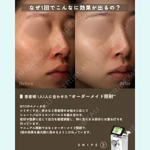 BITO BEAUTY CLINIC 伊藤 富良野医師の症例