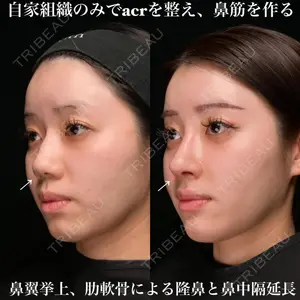 Zetith Beauty Clinic 銀座院 鉄 鑠医師の症例