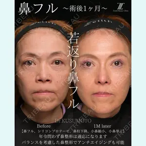 Zetith Beauty Clinic 銀座院 楠本 拓哉医師の症例