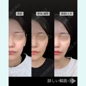 東京シンデレラ美容外科 池袋院 石井 達也医師の症例