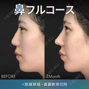 ジョウクリニック 銀座院 重本　譲医師の症例