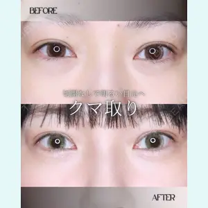 小倉美容外科/美容皮膚科 ビラビューティークリニック 大村 亞蘭医師の症例