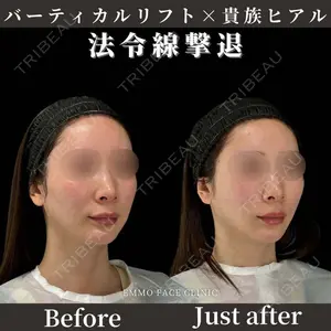 EMMO FACE CLINIC 東京三田院 木之下 哲彦医師の症例