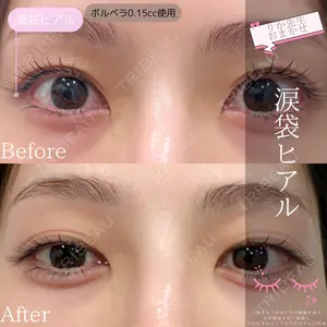 渋谷あおぞらクリニック美容外科・美容皮膚科 川口 理夏医師の症例