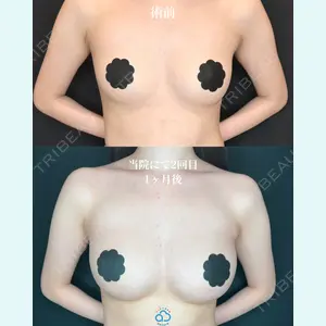 渋谷あおぞらクリニック美容外科・美容皮膚科 鶴田 優希医師の症例