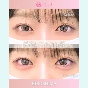 ルラ美容クリニック 広島院の症例
