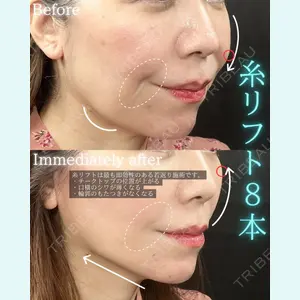 THE FIRST CLINIC 町田院 木暮 啓一郎医師の症例