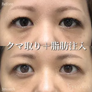 ライブリークリニック 浜松町院 林 政男医師の症例