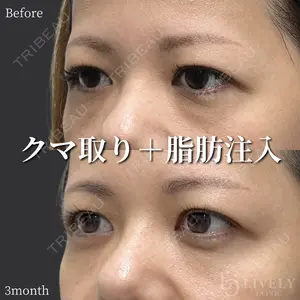 ライブリークリニック 浜松町院 林 政男医師の症例