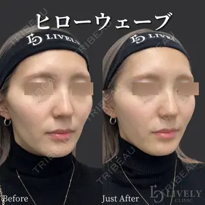 ライブリークリニック 大阪院の症例