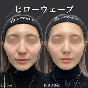 ライブリークリニック 大阪院の症例