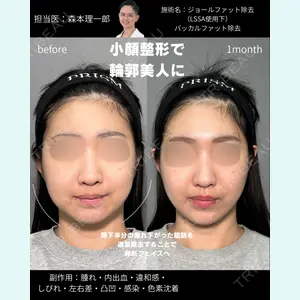 PRISM Beauty Clinic 町田院の症例