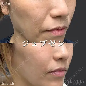 ライブリークリニック 大阪院の症例