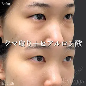 ライブリークリニック 浜松町院 林 政男医師の症例