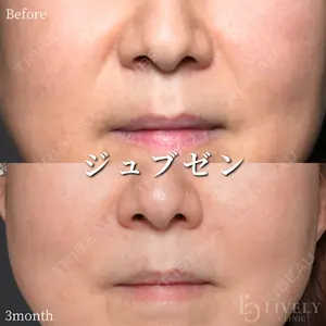 ライブリークリニック 大阪院の症例