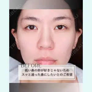 小倉美容外科/美容皮膚科 ビラビューティークリニック 大村 亞蘭医師の症例