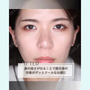 小倉美容外科/美容皮膚科 ビラビューティークリニック 大村 亞蘭医師の症例