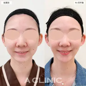 A CLINIC（エークリニック） 大阪院 田窪 賢志郎医師の症例