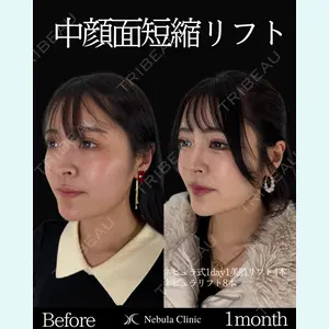 ネビュラクリニック 東京錦糸町院 岩切 琢磨医師の症例