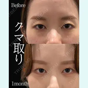 ネビュラクリニック 東京錦糸町院 岩切 琢磨医師の症例