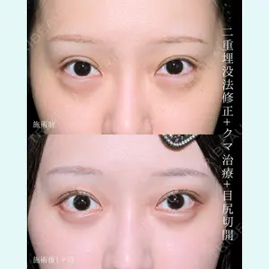 藤・ナチュレ美容クリニック 銀座院 小川 杏平医師の症例