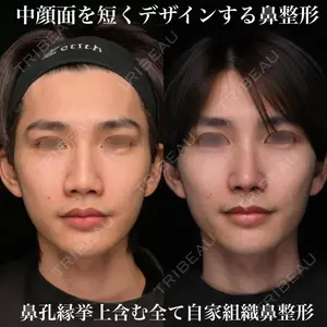 Zetith Beauty Clinic 銀座院 鉄 鑠医師の症例