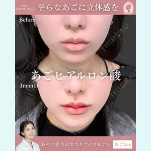 東京シンデレラ美容外科 池袋院 梅田 絢乃医師の症例