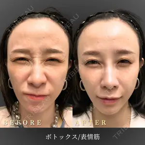 BiBiクリニック 山本 幸一郎医師の症例