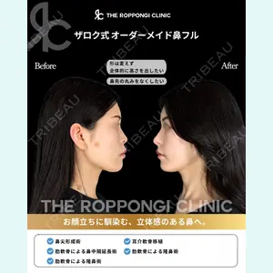 THE ROPPONGI CLINIC（ザ 六本木クリニック） 石黒 昂医師の症例