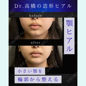 吉祥寺アイビークリニック 高橋 京佑 医師の症例