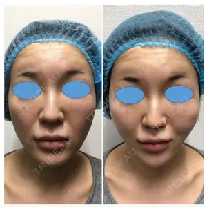 しのぶ皮膚科 蘇原しのぶ医師の症例