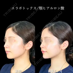 アリエル美容クリニック 大宮院 鈴木　桂介医師の症例